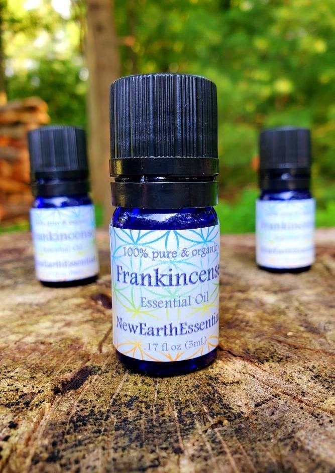 frankincense essential oil